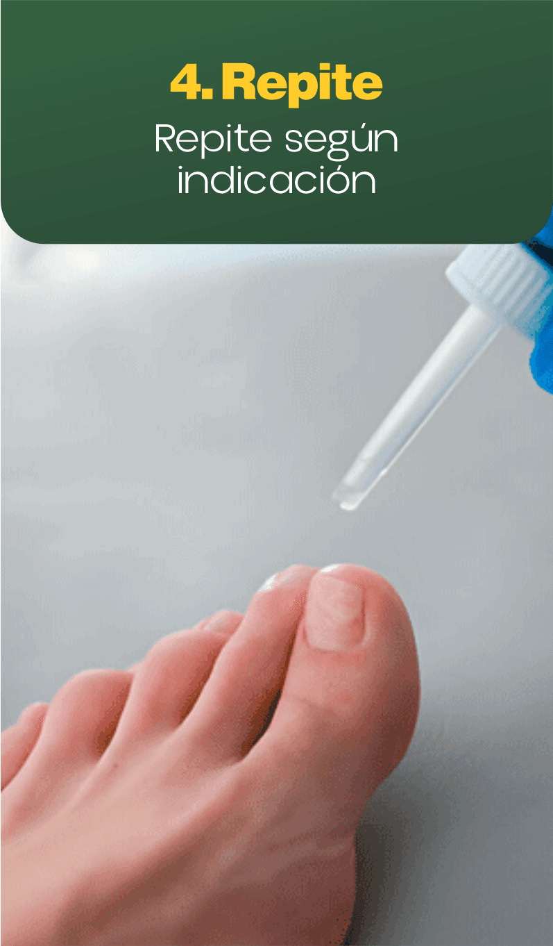 4. Repite
